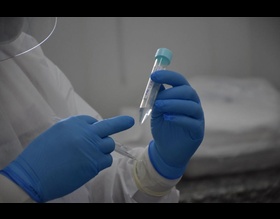 Parcerias público privadas aumentam capacidade de testagem em massa em Botucatu